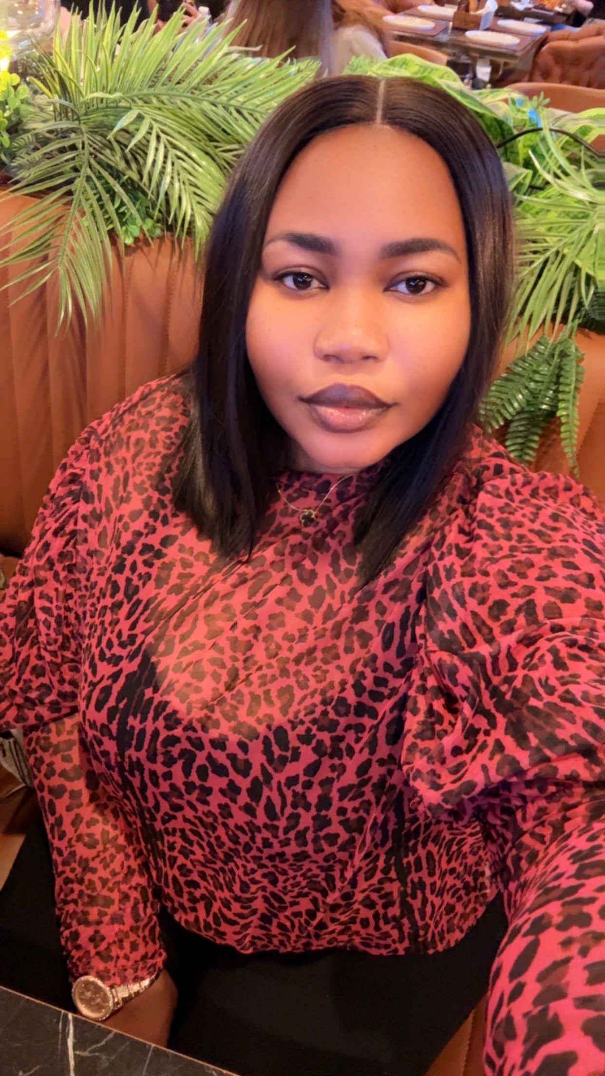 SDD donor bone straight