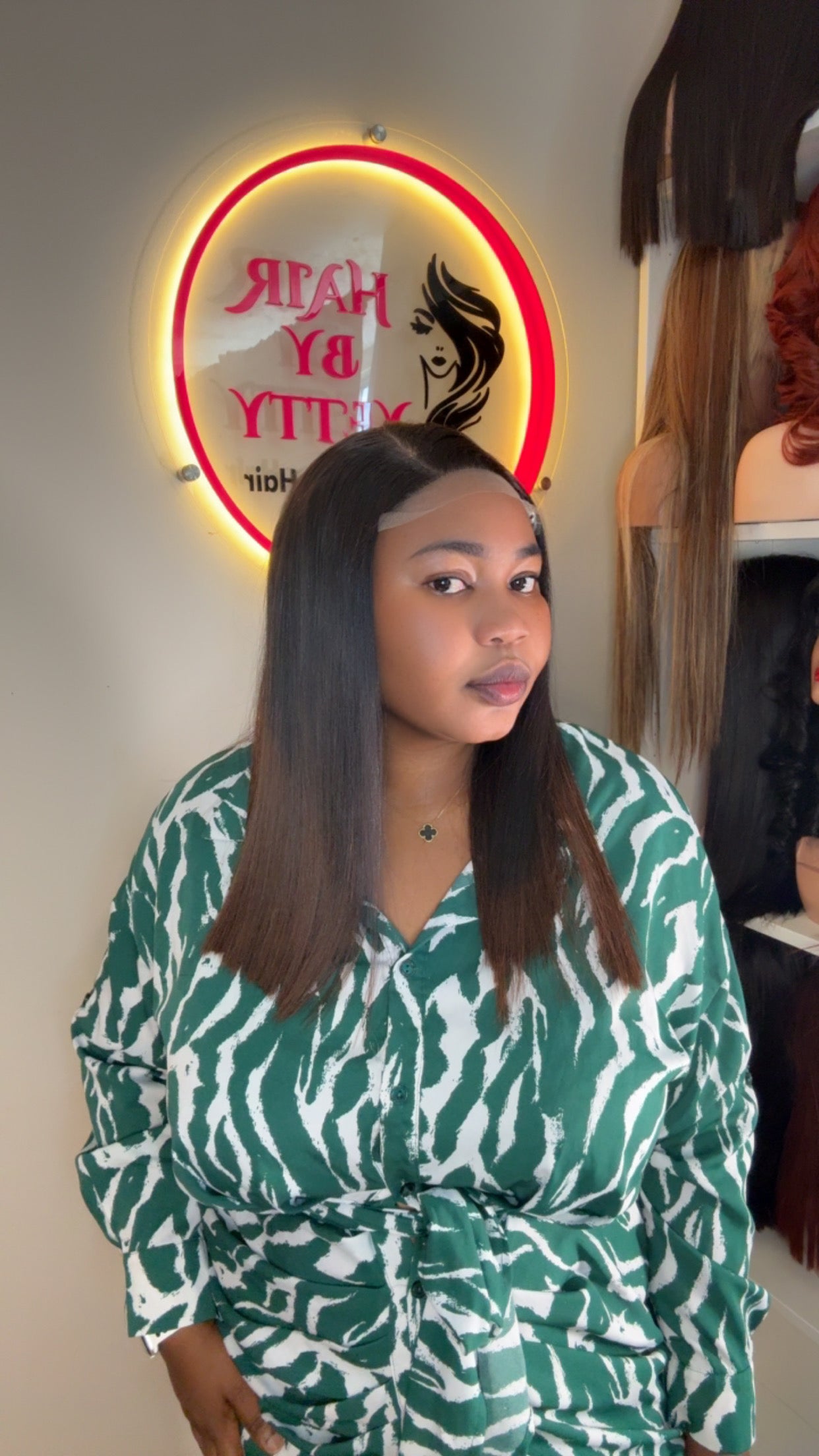 SDD donor bone straight