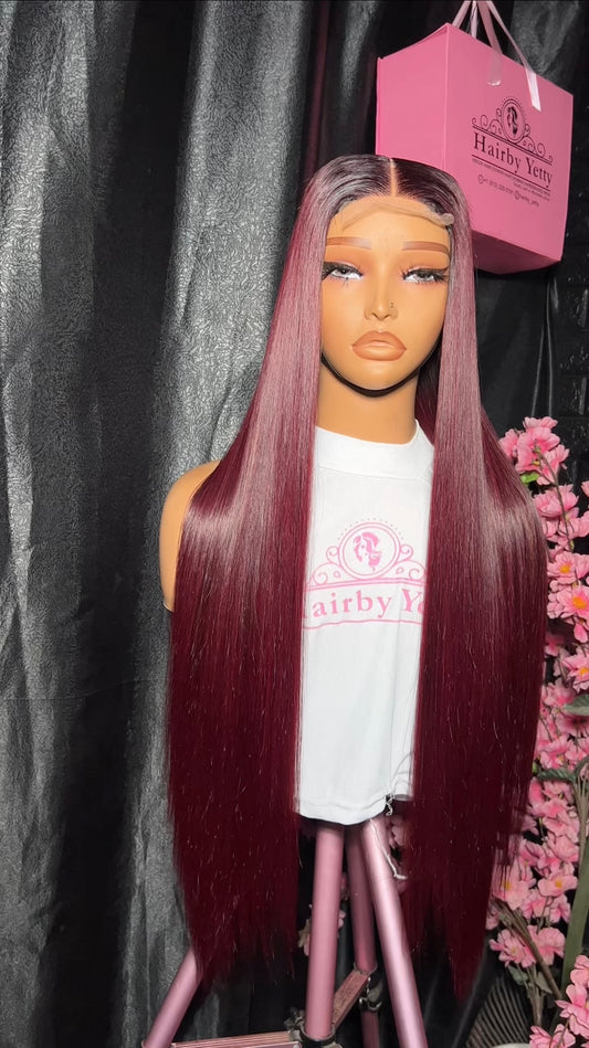 SDD donor bone straight