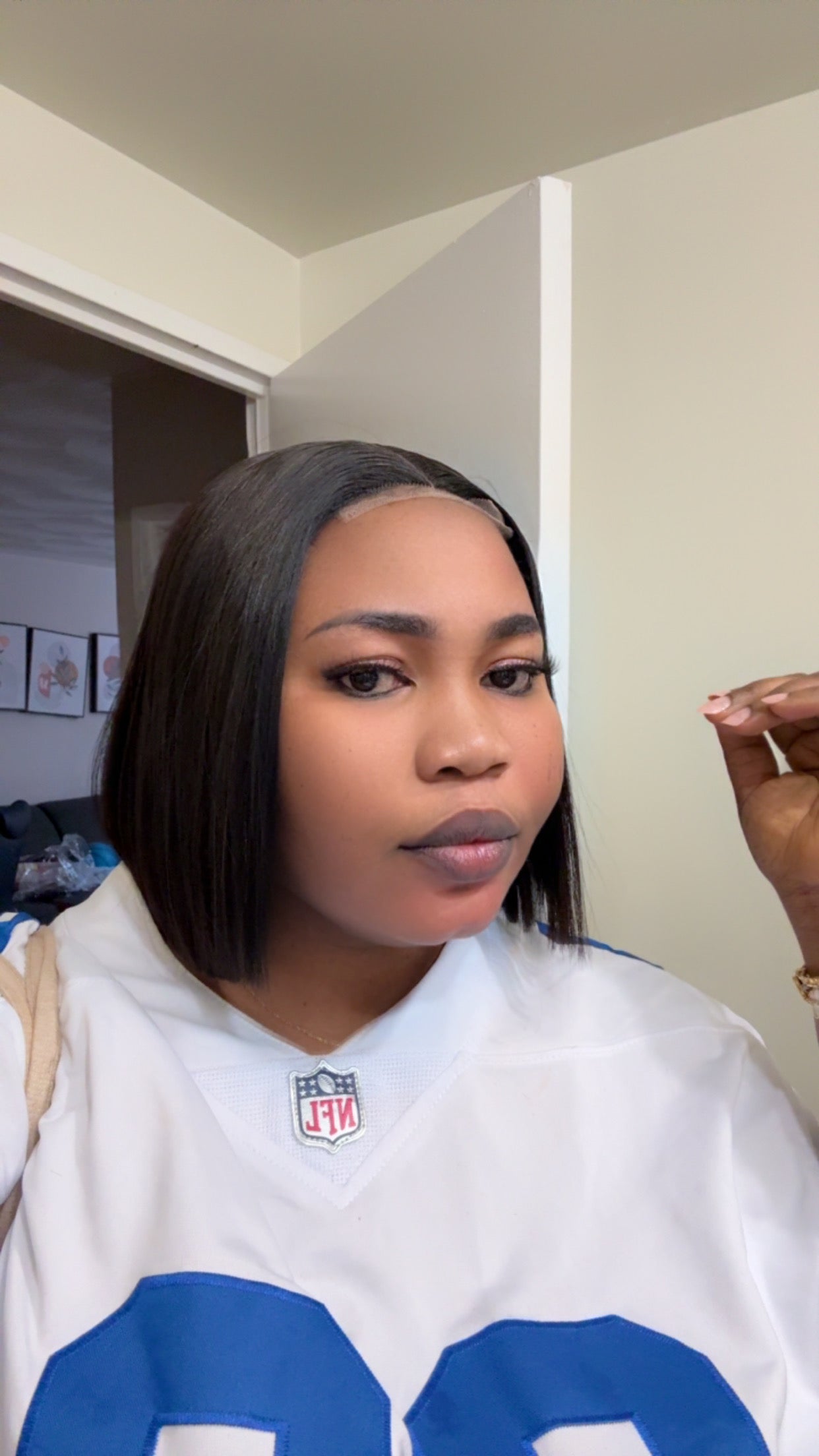 SDD donor bone straight