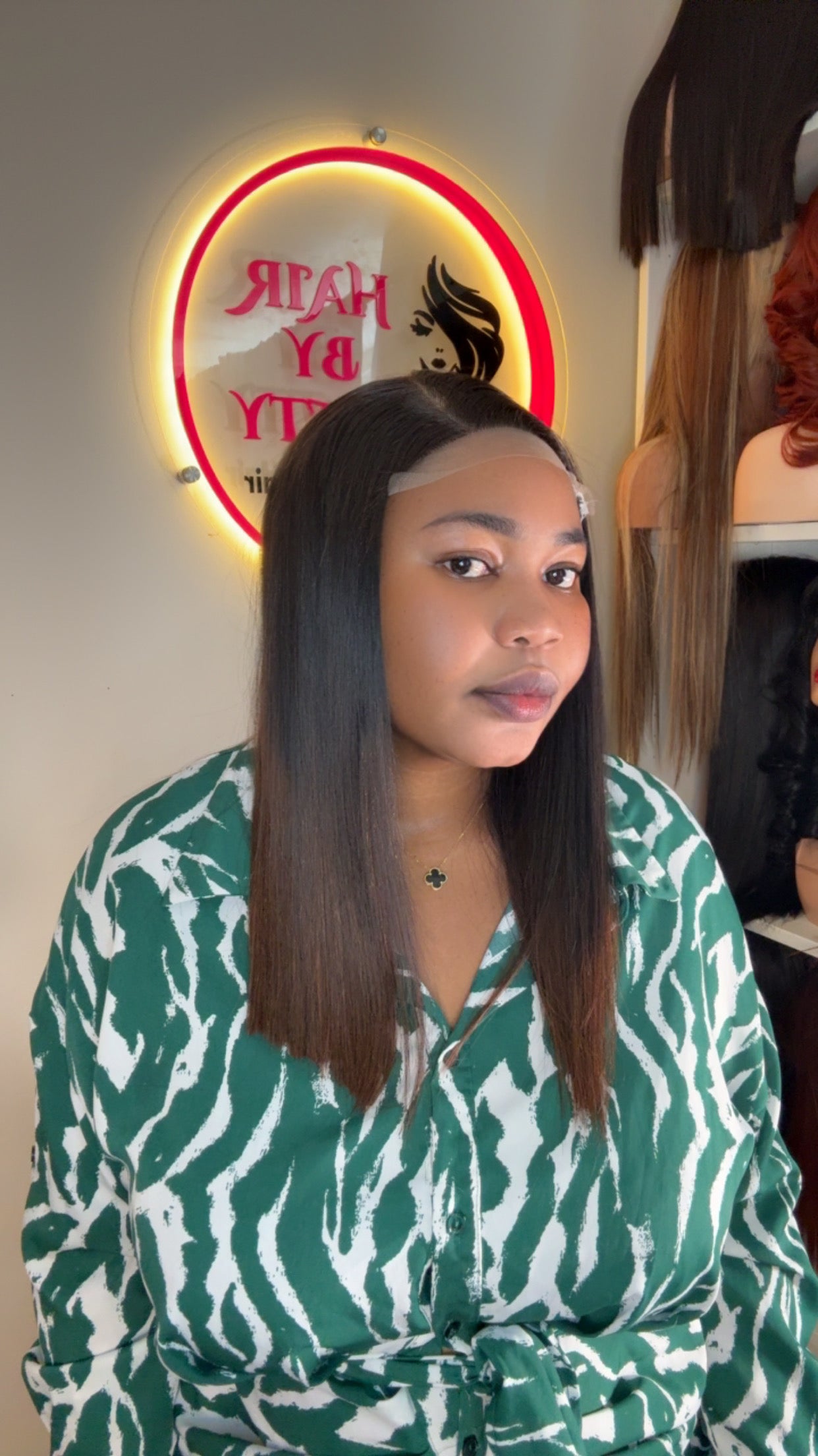 SDD donor bone straight