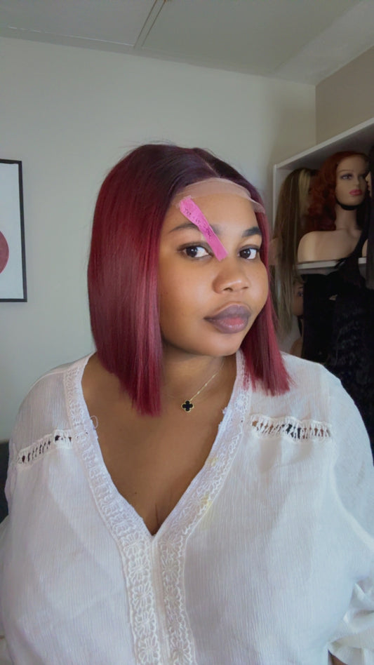 SDD donor bone straight