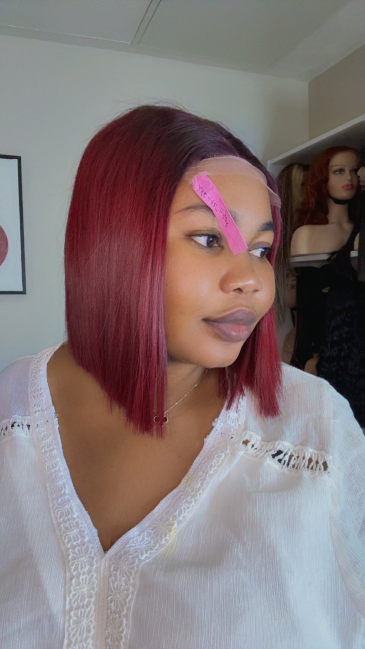 SDD donor bone straight