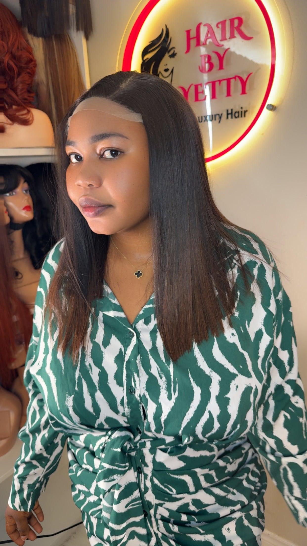 SDD donor bone straight